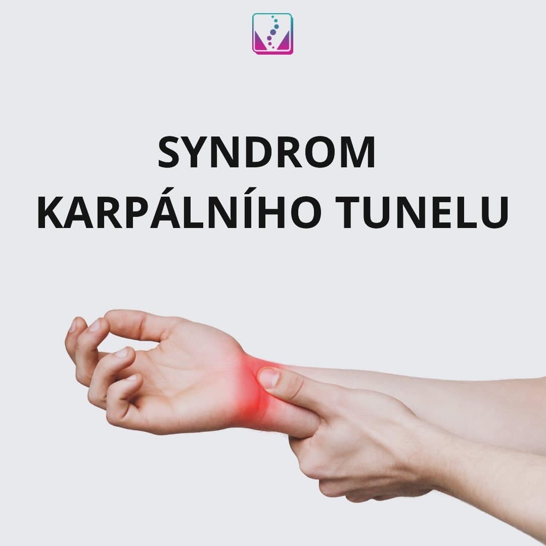 Syndrom karpálního tunelu