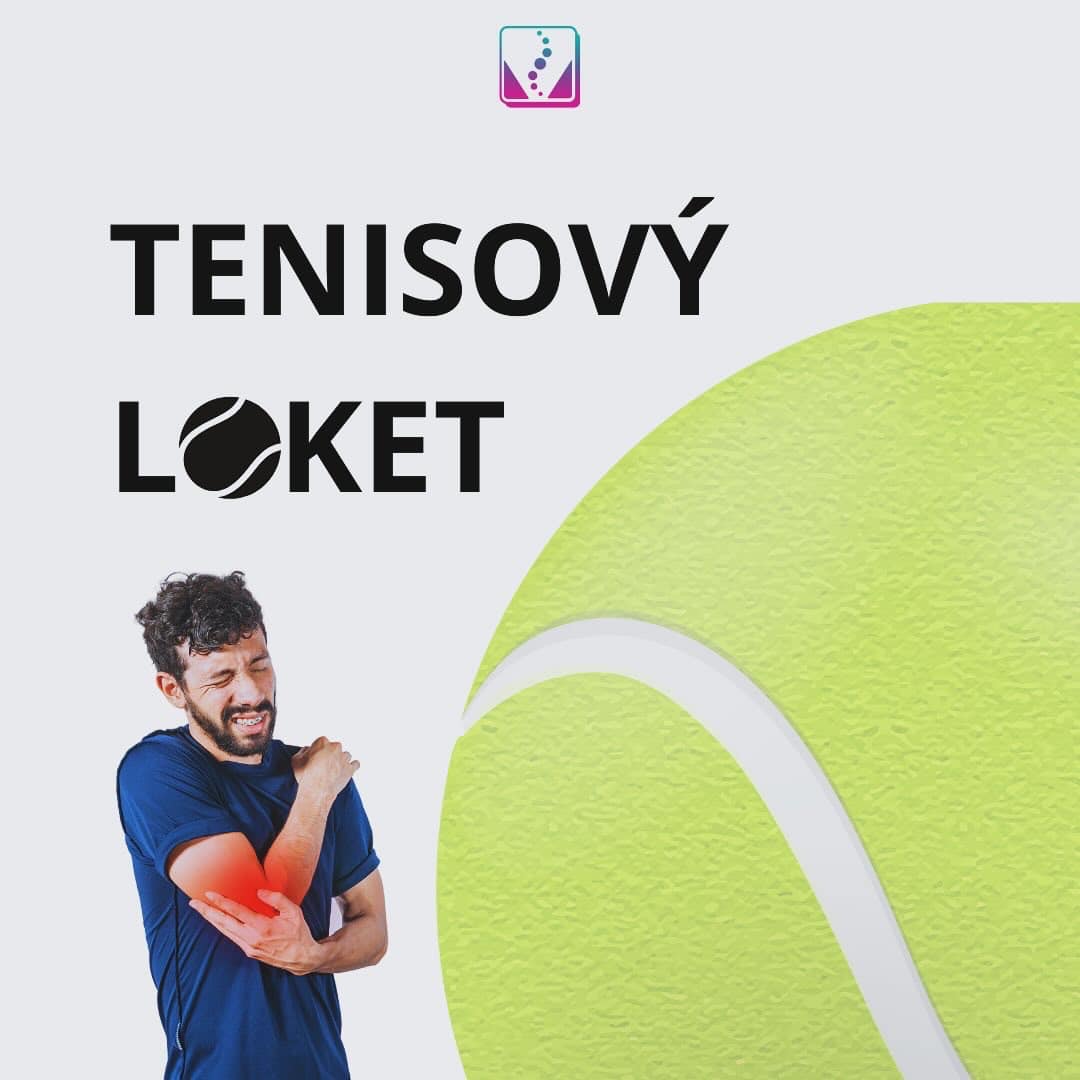 Tenisový loket